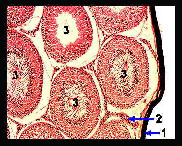 Unit_18-11a