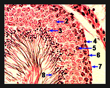 Unit_18-13a