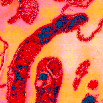 Sporozoite following cytoskeletal paralysis by Michael Riggs.