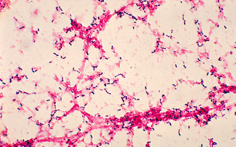 S. pneumoniae on a blood culture