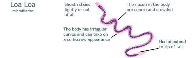 loa loa microfilariae drawing, Illustration by Wilson Vientos