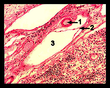 Unit_11-13a