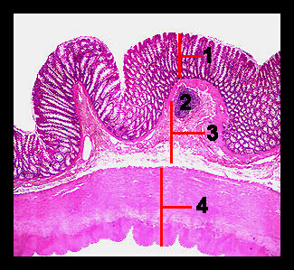 Unit_12-28a