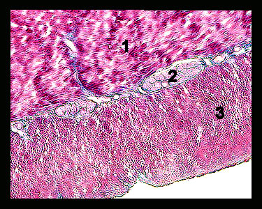 Unit_12-37a