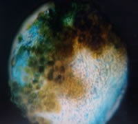Genus trebouxia photobiont within a mycobiont