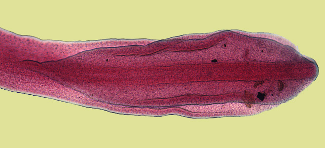 Fish tapeworm; public domain photo - click to follow to original sourc