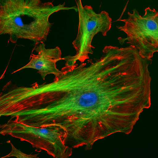 Endothelial cells under the microscope. Nuclei are stained blue with DAPI, microtubles are marked green by an antibody bound to FITC and actin filaments are labelled red with phalloidin bound to TRITC. Photo taken by de:Benutzer:Jan R.