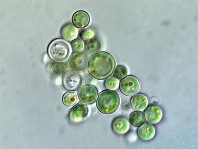 Cyanidium.  Image from http://ja.wikipedia.org/wiki/%E3%83%95%E3%82%A1%E3%82%A4%E3%83%AB:Cyanidium_O5A.jpg 