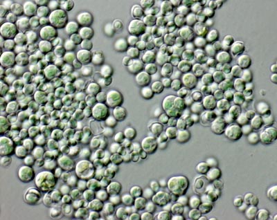 Cyanidium caldarium.  Image from http://starcentral.mbl.edu/microscope/portal.php?pagetitle=assetfactsheet&imageid=12361