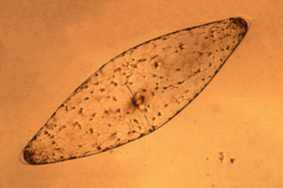 Image used with Permission,  E. Widder/ORCA. http://www.reed.edu/biology/professors/srenn/pages/teaching/web_2010/MDCM_dinoflagellates/mechanism.html