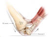 Muscle Attachment Site. Copyright Mike Habib. Accessed November 23, 2013.