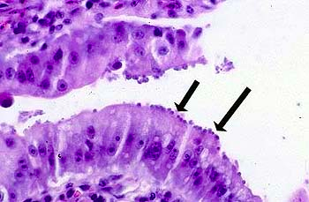 C. parvum in intestine from http://www.vet.uga.edu/ivcvm/courses/vpat5215/digestive/week04/enteric/entericeight.htm