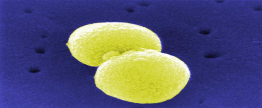 Streptococcus pneumoniae (Pneumococcus, SEM-Picture)
