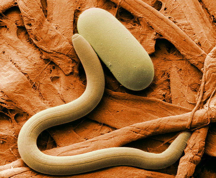 Wikipedia: Soybean cyst nematode and egg