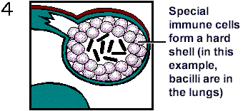 Centers for Disease Control and Prevention. http://www.phppo.cdc.gov/phtn/tbmodules/modules1-5/m1/con6a.htm