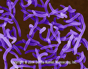 Vibrio cholerae. © 2007 Dennis Kunkel Microscopy, Inc. 