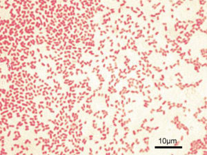 A Gram negative bacilli bacteria.