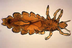 A close look at a human louse, photo courtesy of CDC.