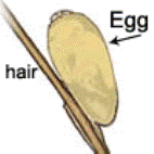 An egg of Pediculus humanus, photo courtesy of CDC.