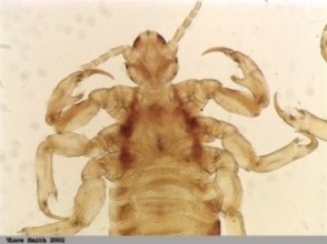 A closer look at the six legs of human lice, photo courtesy of Vince Smith.