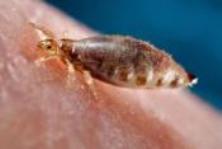 A louse feeding on its host, photo courtesy of Jim Gathany of CDC.