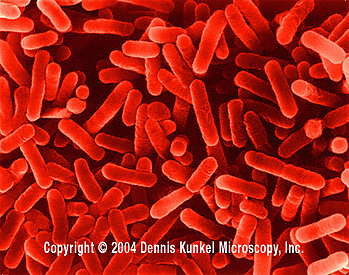 Legionella pneumophila image courtesy of Dennis Kunkel