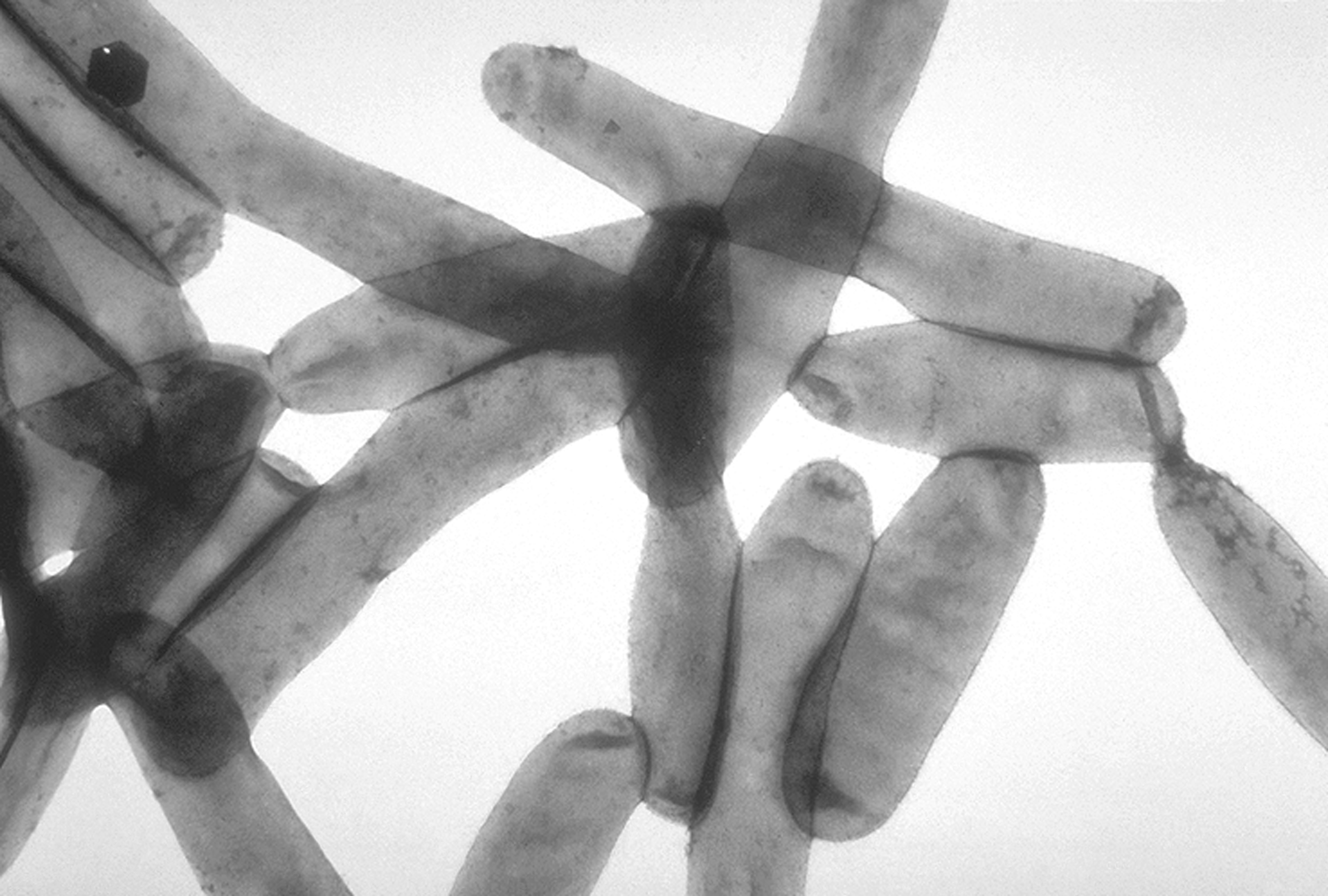 Legionella pneumophila image found at Wikipedia.org