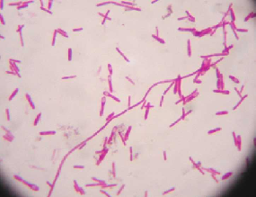 A microscopic view of Clostridium botulinum