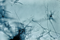 picture of streptomyces sp. found in a free domain