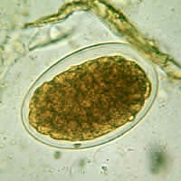 Hookworm egg- DPDx CDC