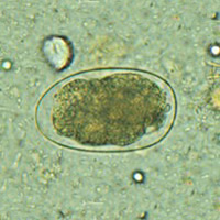 Hookworm egg- DPDx CDC