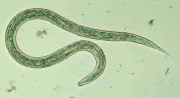 Hookworm- DPDx CDC
