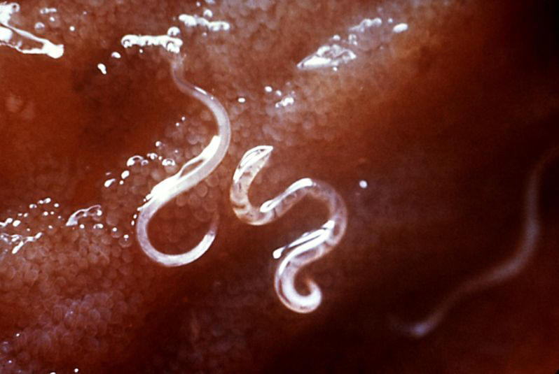 Hookworm feeding- Wikimedia Commons