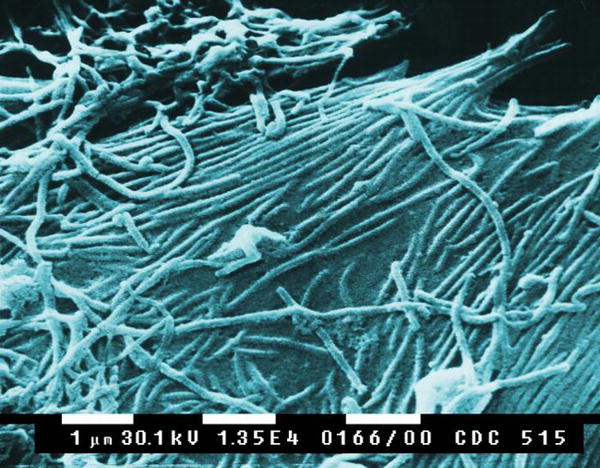 of Ebola virions is shown at left. The virus was first detected in wild 