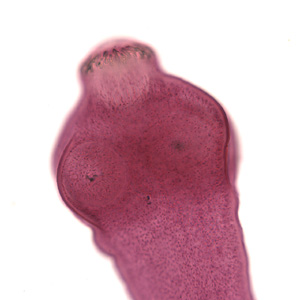 Scolex of E. granulosus obtained from www.dpd.cdc.gov