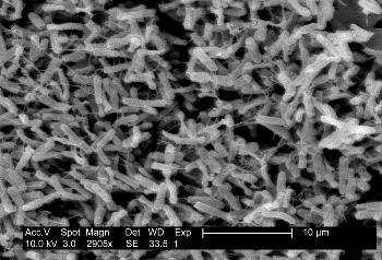 Micrograph of Clostridium difficile from a stool sample (From: Public Doman- CDC)