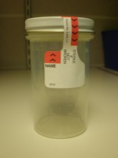 Specimen container (Picture taken by me)
