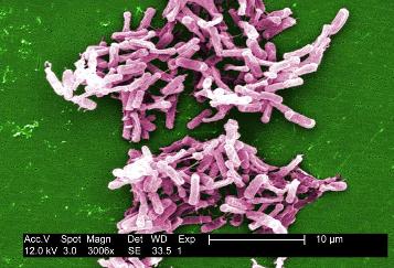 A micrograph of Gram-positive Clostridium difficile from a stool sample (From: Public Health Image Library [CDC] http://phil.cdc.gov/phil/home.asp)