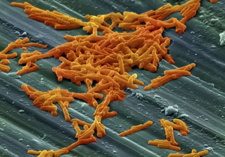 cluster of Clostridium difficile bacteria on a surface (Used under creative commons license from Wellcome Images Online)