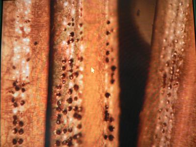 Rhizospaera needle cast fruiting bodies emerging from stomata along blue spruce needles