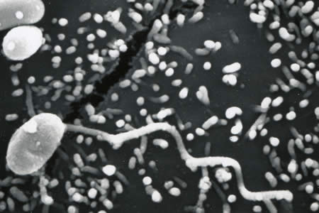 An electron micrograph of a microsporidian spore tube inserting into a eukaryotic cell Image from http://www.dpd.cdc.gov/dpdx/HTML/ImageLibrary/M-R/Microsporidiosis/body_Microsporidiosis_il5.htm