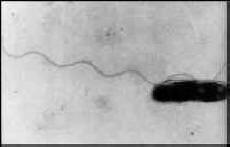 Legionella pneumophila (Image located at http://www.osha.gov/dts/osta/otm/legionnaires/disease_rec.html)