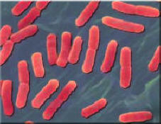 Escherichia coli (Image located at http://www.lbl.gov/Science-Articles/Archive/sb-ESD-cataloging-bacteria.html)