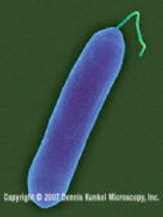 Salmonella enteritidis (Copyright Dennis Kunkel Microscopy, Inc.)