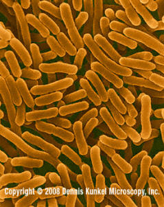 Salmonella enterica (Copyright Dennis Kunkel Microscopy, Inc.)