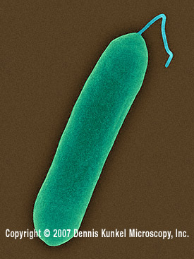 Salmonella enteritidis (Copyright Dennis Kunkel Microscopy, Inc.)