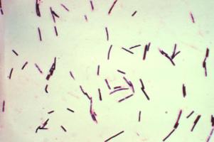 Clostridium perfringens--Courtesy of Wikimedia Commons