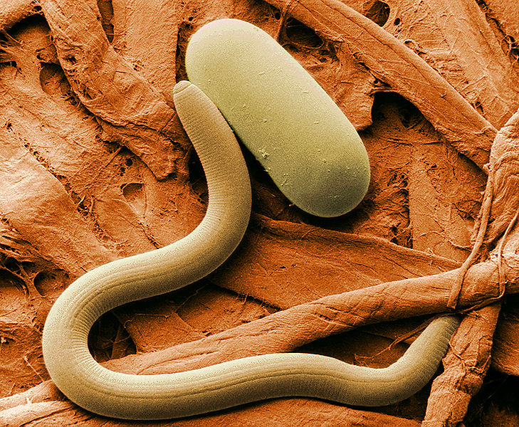 Soybean cyst nematode and egg photo courtesy of the Agricultural Research Service