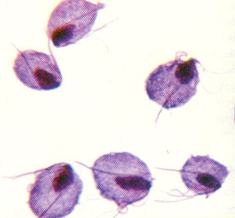 Trichomonas Vaginalis
- 4 Flagella
-TRICH
... - Flashcard