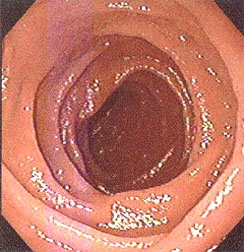 The inside of Duodenum, also known as the first section of the human's small intestine.